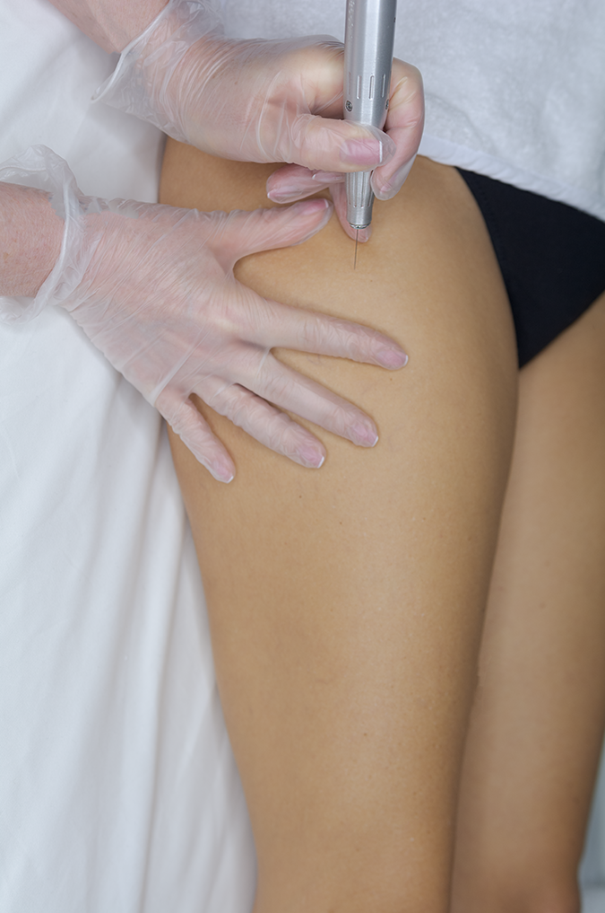 Med Spa in Plantation