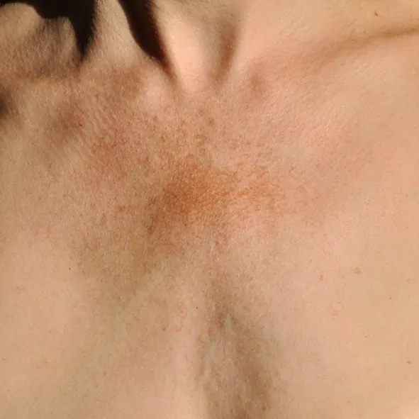 Med Spa in Plantation