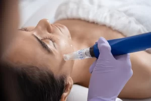 How to Care for Your Skin After a Med Spa Treatment